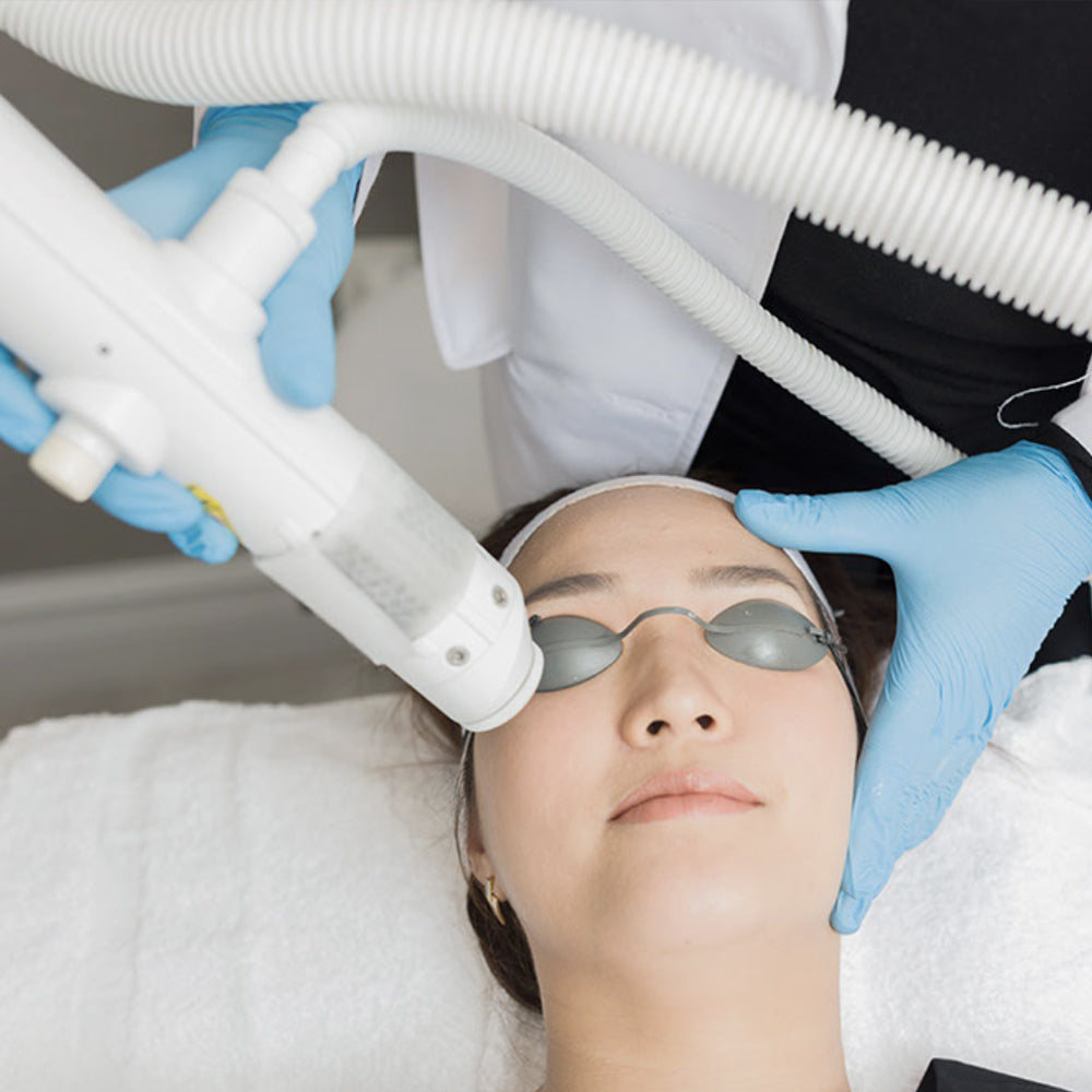 Laser Facials + IPL (Black Friday)