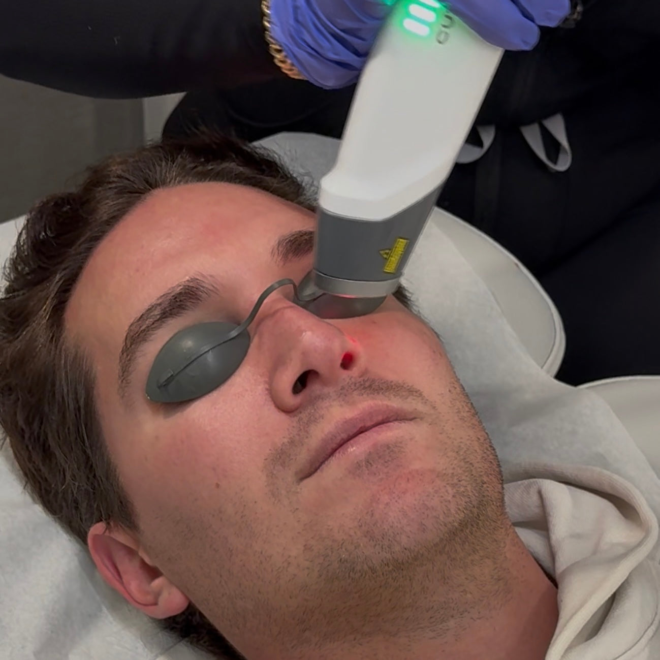 Laser Skin Reset | Glass Skin Facial Experience