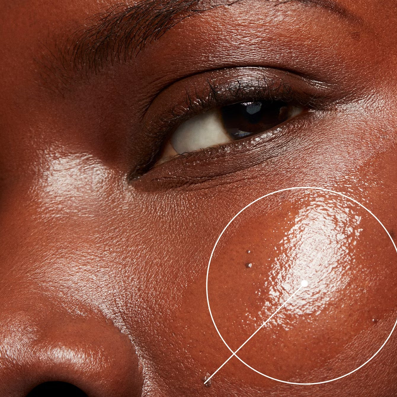 Comprehensive Skin Analysis