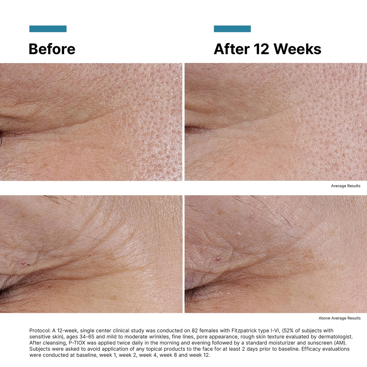 SkinCeuticals P-TIOX Anti-Wrinkle Peptide Serum (30ML)