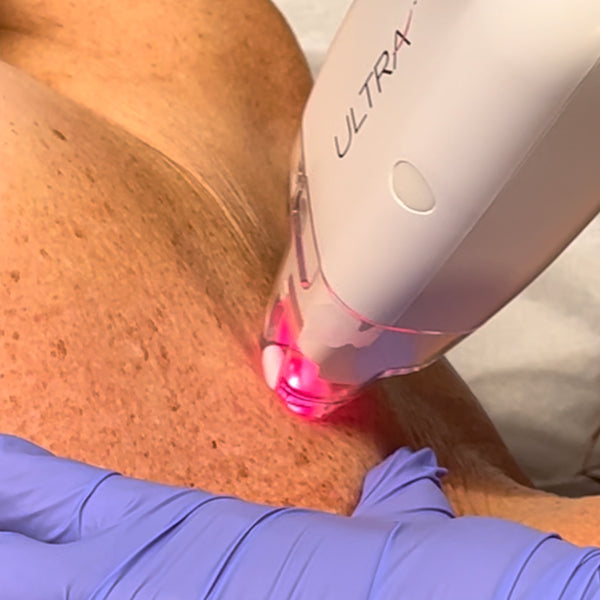 LaseMD Ultra (Black Friday) Buy 3 Get 4th Free