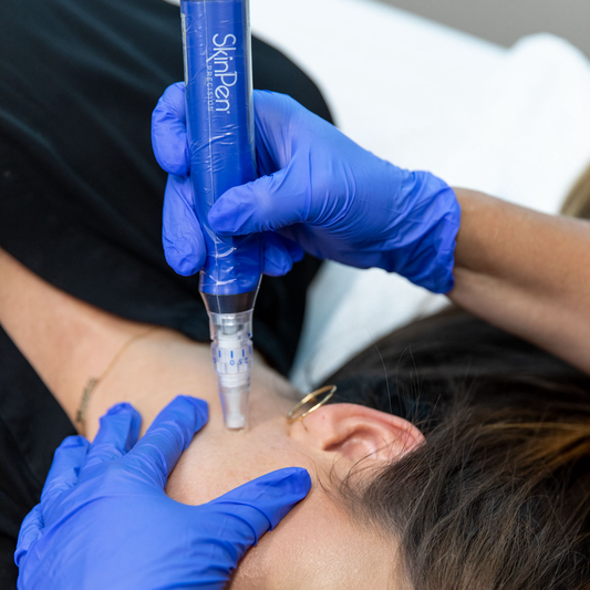 SkinPen + Rejuran Salmon DNA Facial / Exosomes (Black Friday)